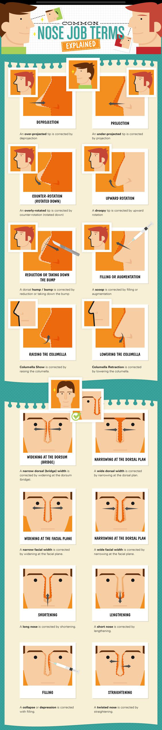 Common Rhinoplasty Terms Explained